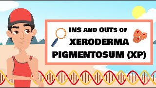 The Ins and Outs of XP Xeroderma pigmentosum [upl. by Richarda]