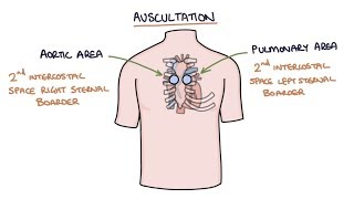 Heart Murmurs and Heart Sounds Visual Explanation for Students [upl. by Beker503]