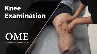 Knee Examination  Orthopaedics [upl. by Follansbee137]