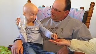 Living With Progeria 30 Min Documentary  BORN DIFFERENT [upl. by Selway]