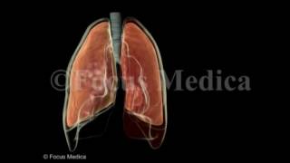 Hemothorax  Lungs [upl. by Noreg284]