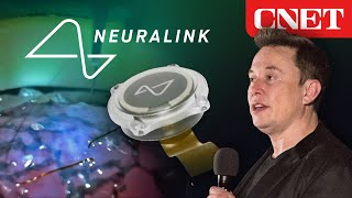 Elon Musk’s Neuralink Event Everything Revealed in 10 Minutes [upl. by Ecinaej]