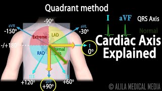 Cardiac Axis Interpretation Animation [upl. by Hephzibah148]