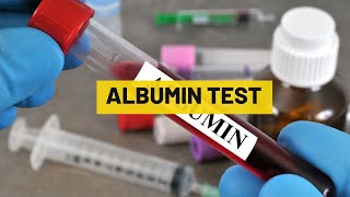 Albumin Test  My Lab Solution [upl. by Red47]