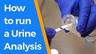 How to run a Urine Analysis [upl. by Aekerly]