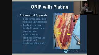 Humeral Shaft Fractures  John Callaghan MD [upl. by Zeph]