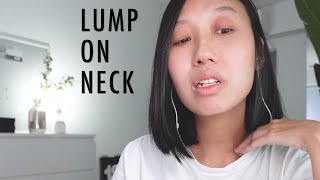 AskUNMC Head amp Neck Cancer Warning Signs [upl. by Nolur]