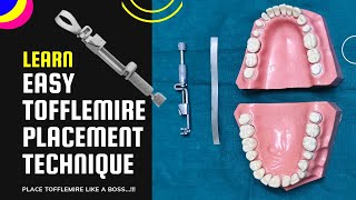 How to place Tofflemire matrix band  easy steps [upl. by Lapointe874]