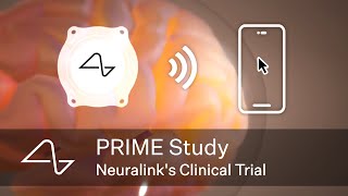 Neuralink’s Clinical Trial The PRIME Study [upl. by Mandler]