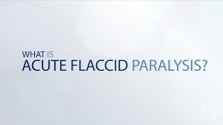 Flaccid dysarthria  samples and explanation [upl. by Ojadnama]