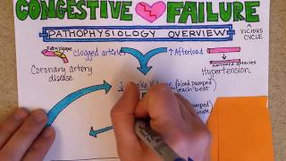 Congestive Heart Failure Pathophysiology [upl. by Noremmac]